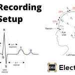 心电图记录装置(方框图和波形)